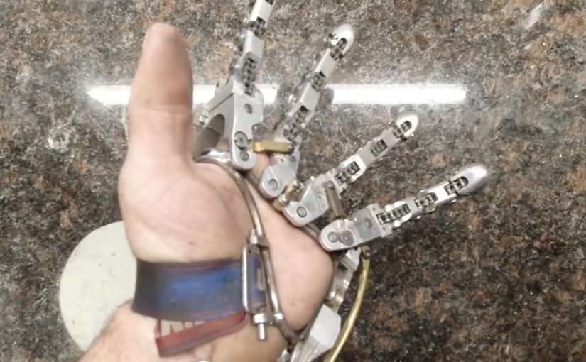 Best of 2020: This Guy Built His Own Prosthetic Hand Setup With Aluminum!